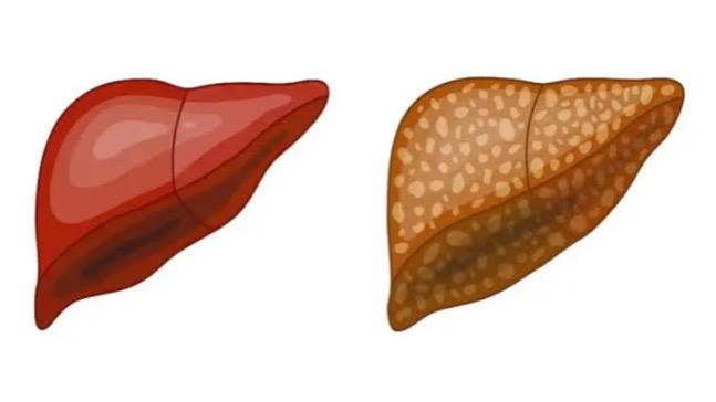 AA38694C-80FA-4C00-BCE2-3822B424BE5F